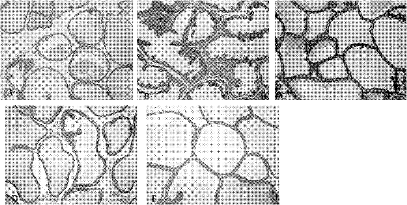 Application of gallocatechin gallate in preparation of benign prostatic hyperplasia resistant medicament