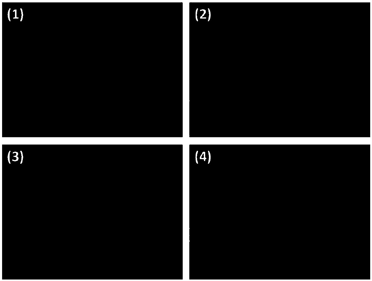 Application of specific antibody, implantable medical instrument and preparation method of implantable medical instrument