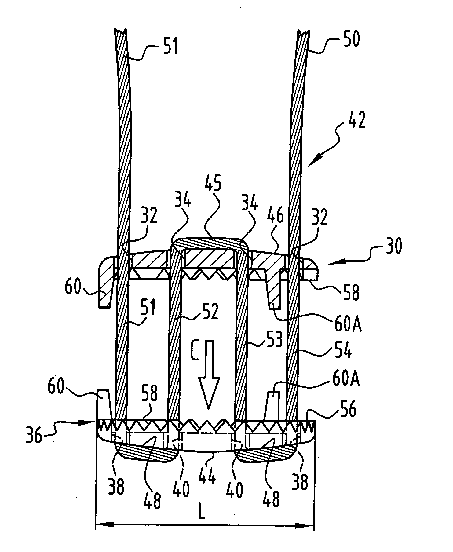 Implant for fixing bone plates