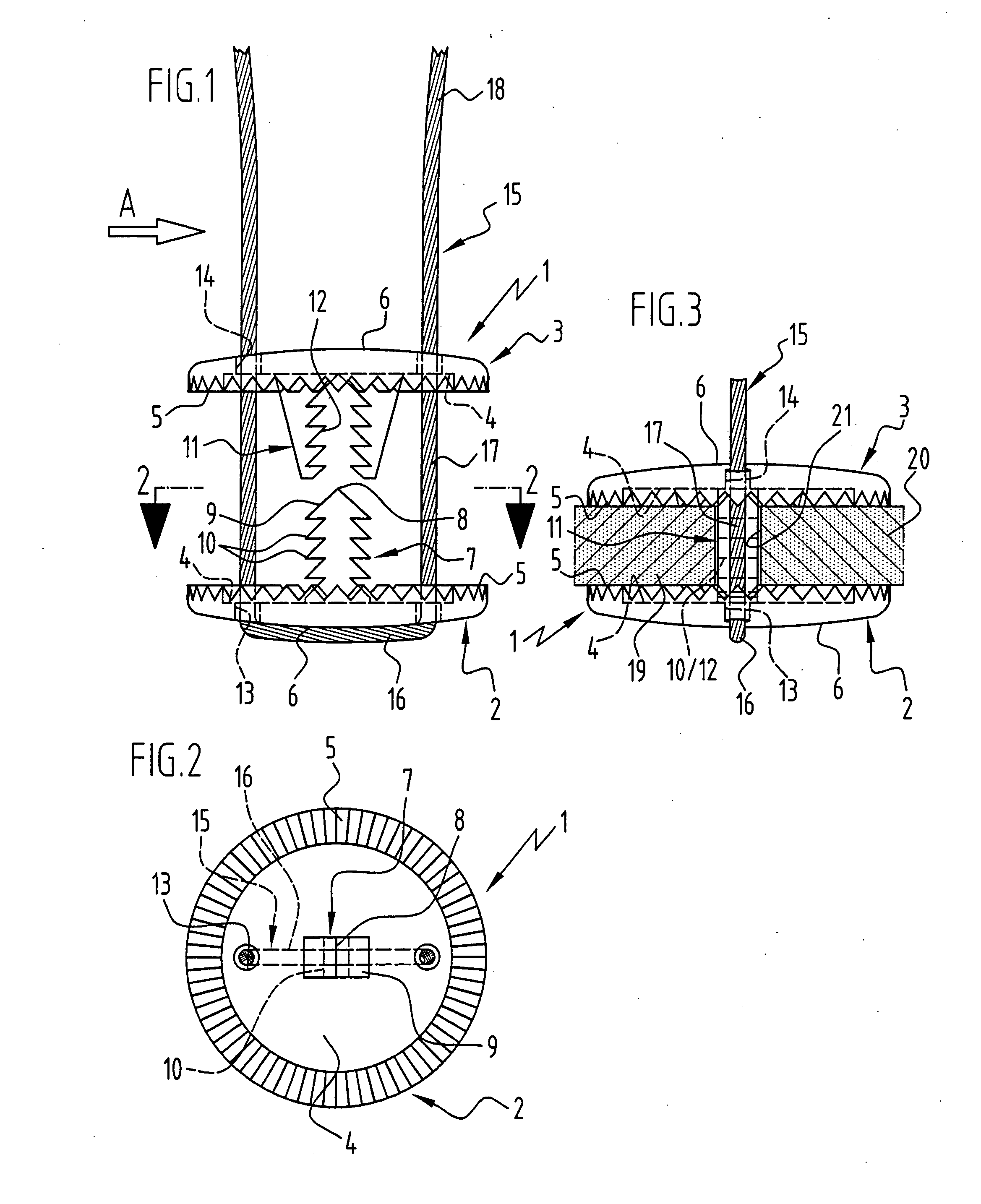 Implant for fixing bone plates