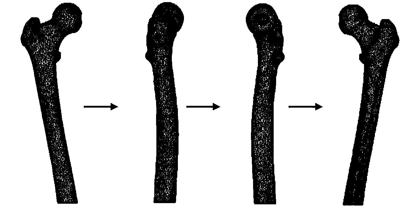 Thighbone biomechanics finite element analysis system based on force feedback