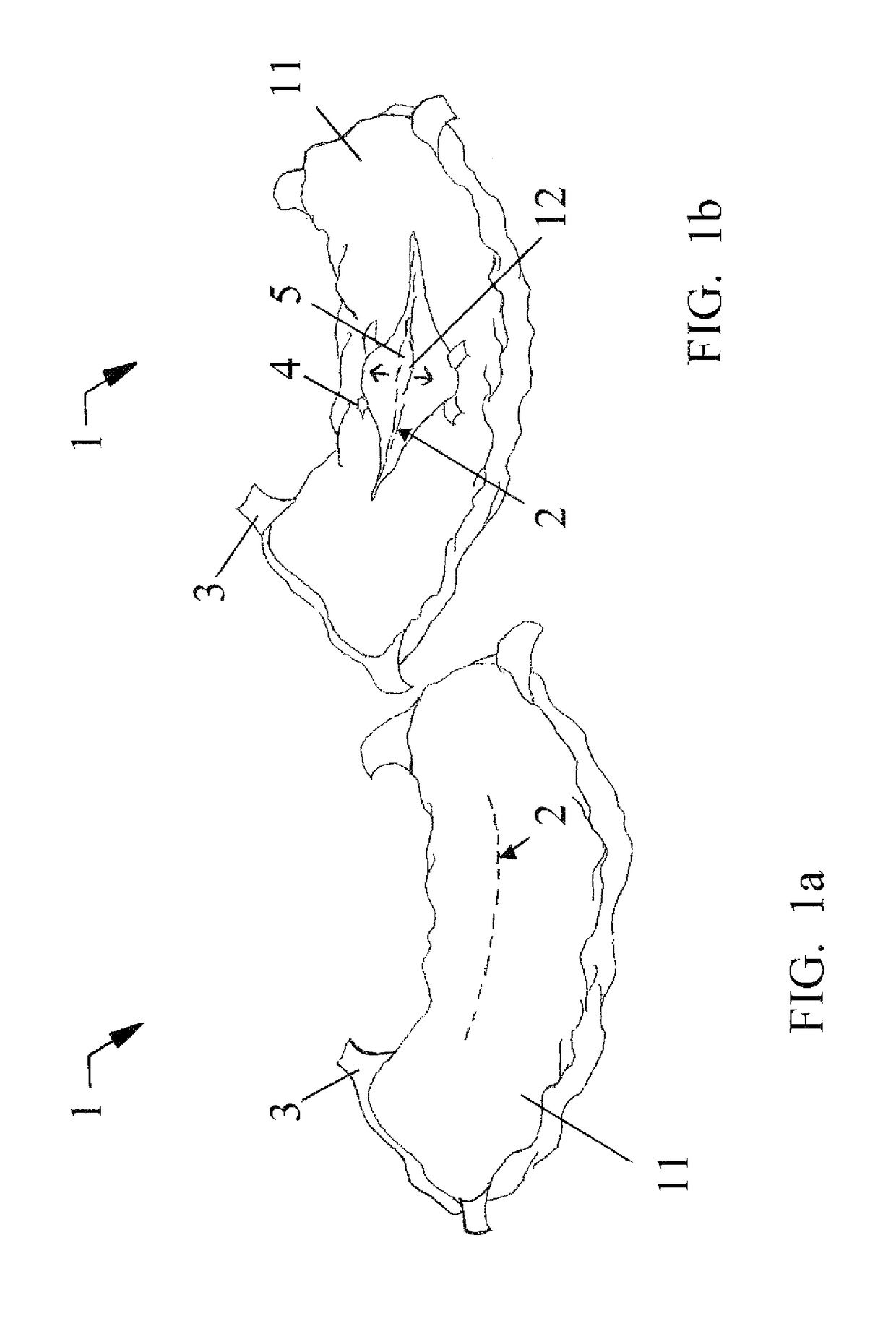 Anti-channeling stool management system