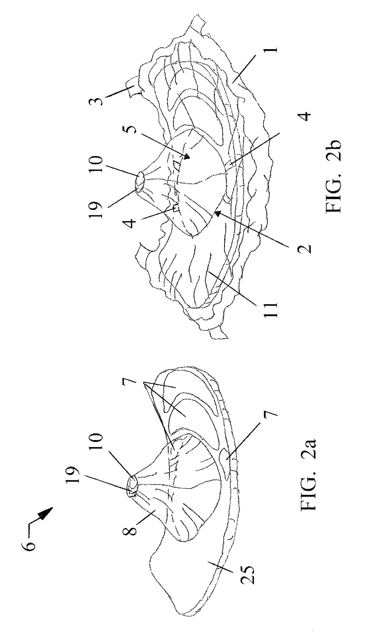 Anti-channeling stool management system