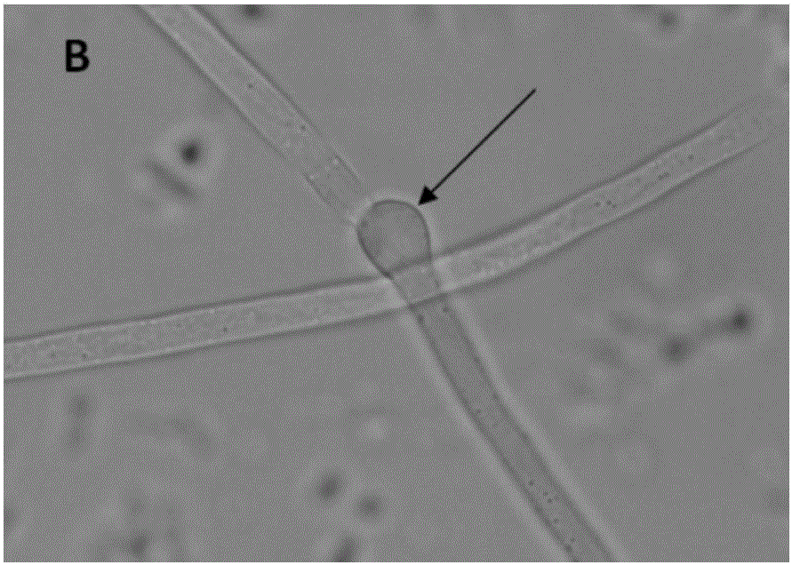 Bacillus amyloliquefaciens strain and application thereof