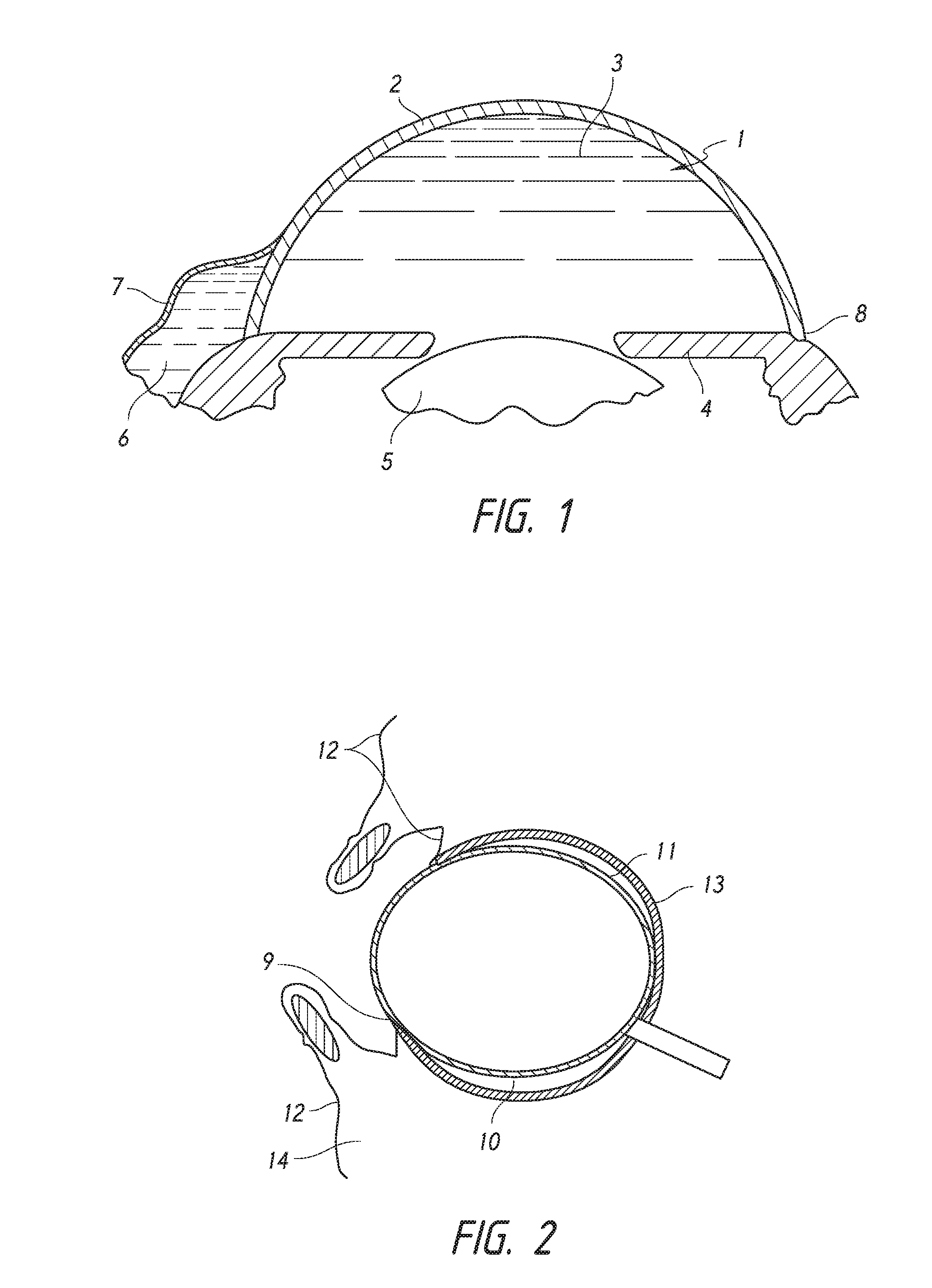 Methods for implanting intraocular shunts