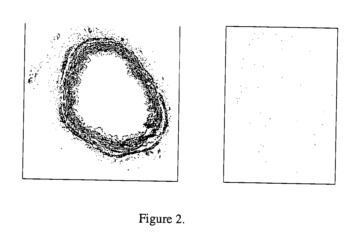 Vascular graft sterilization and decellularization