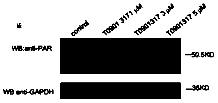 Use of T0901317 as a PARP1 inhibitor