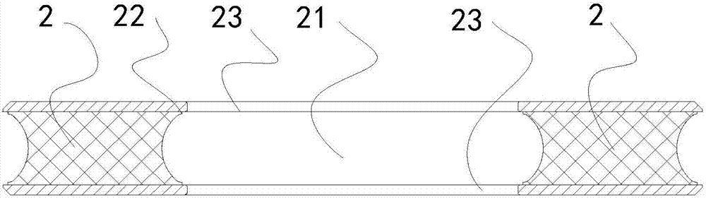 Externally-convex core and vulcanized mould