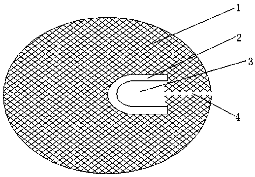 Hernia patch with U-shaped magnet