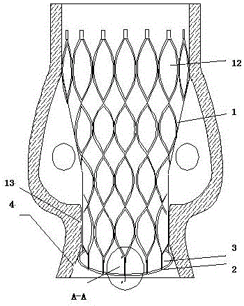 A new type of artificial heart valve