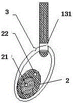 A new type of artificial heart valve