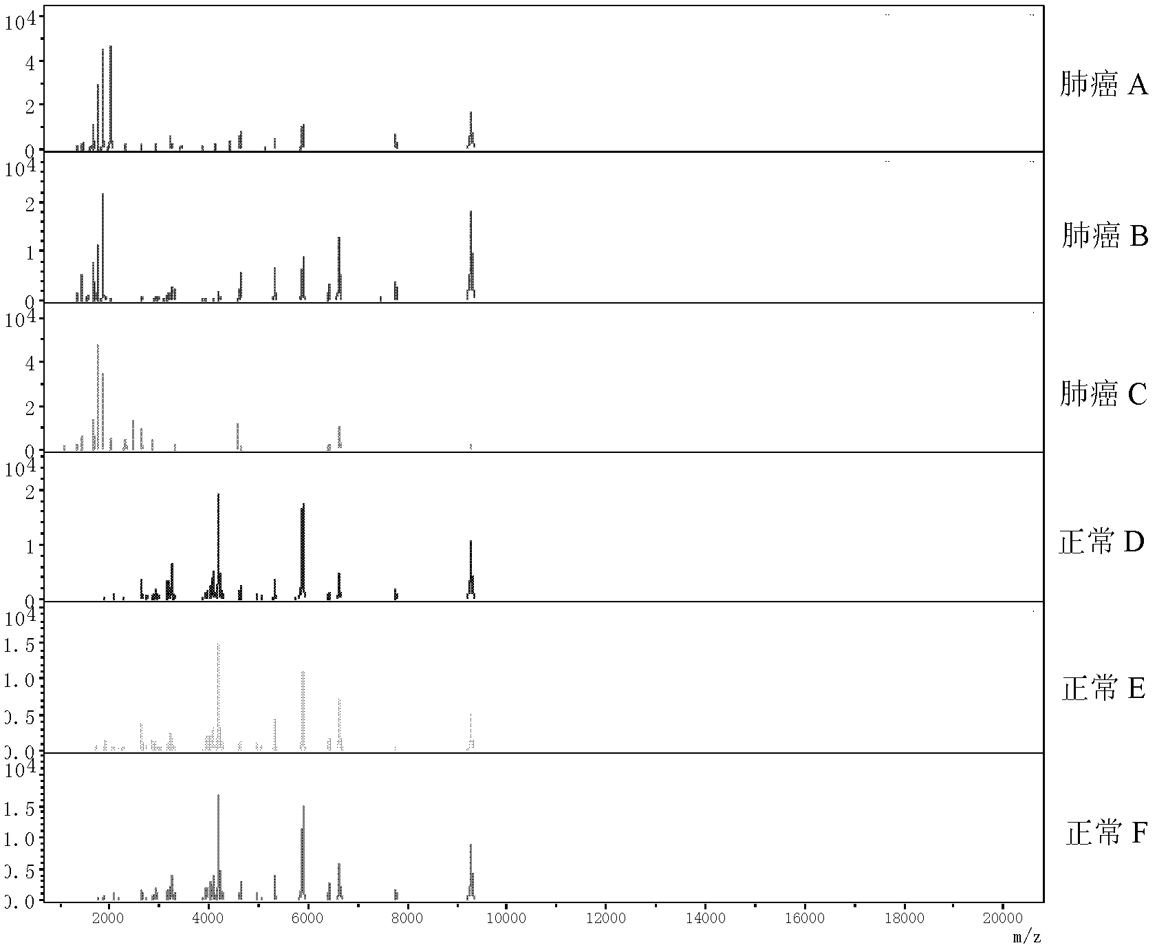 Mass spectrum model for detecting proteins of lung cancer and construction method thereof