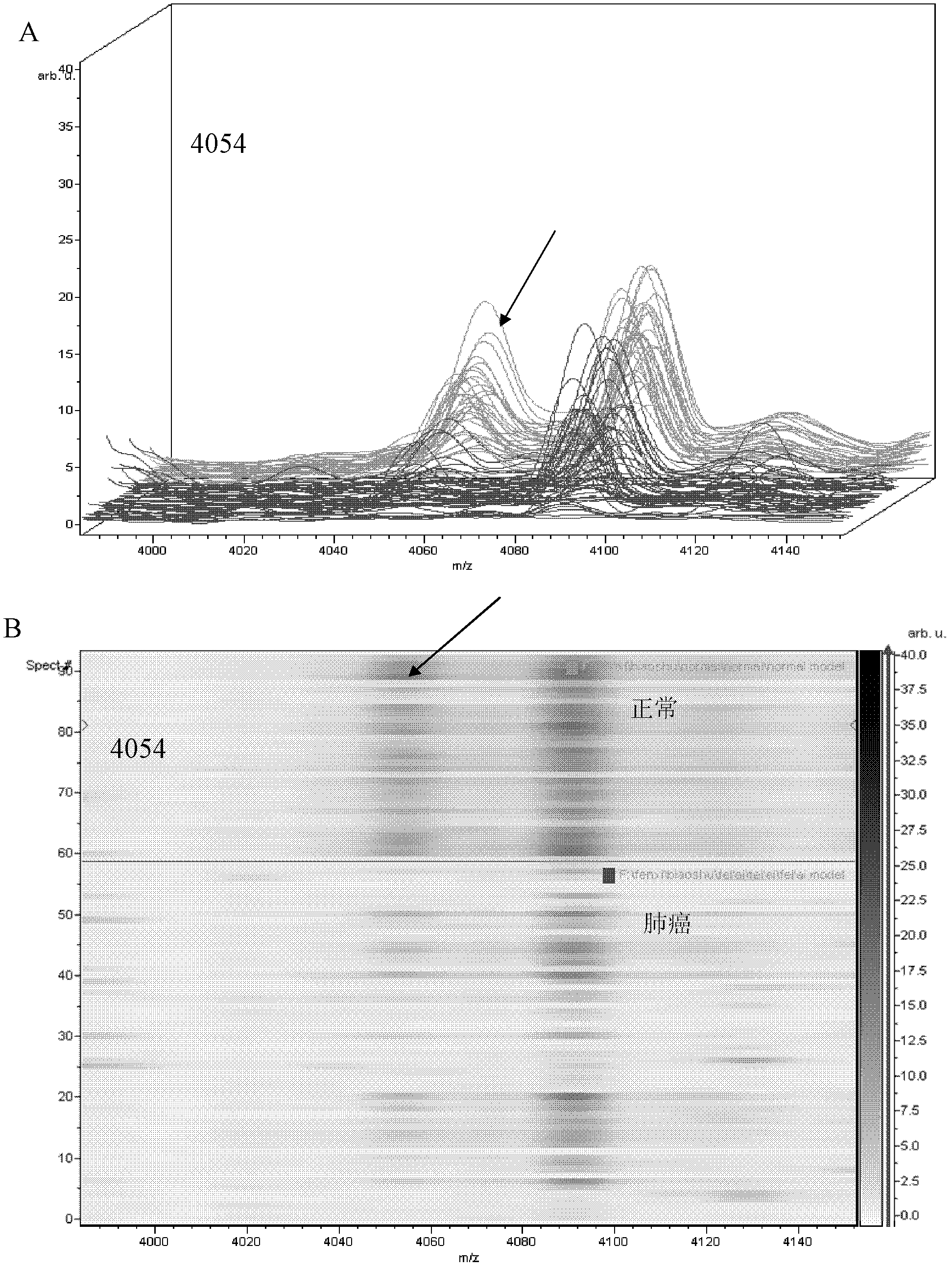 Mass spectrum model for detecting proteins of lung cancer and construction method thereof