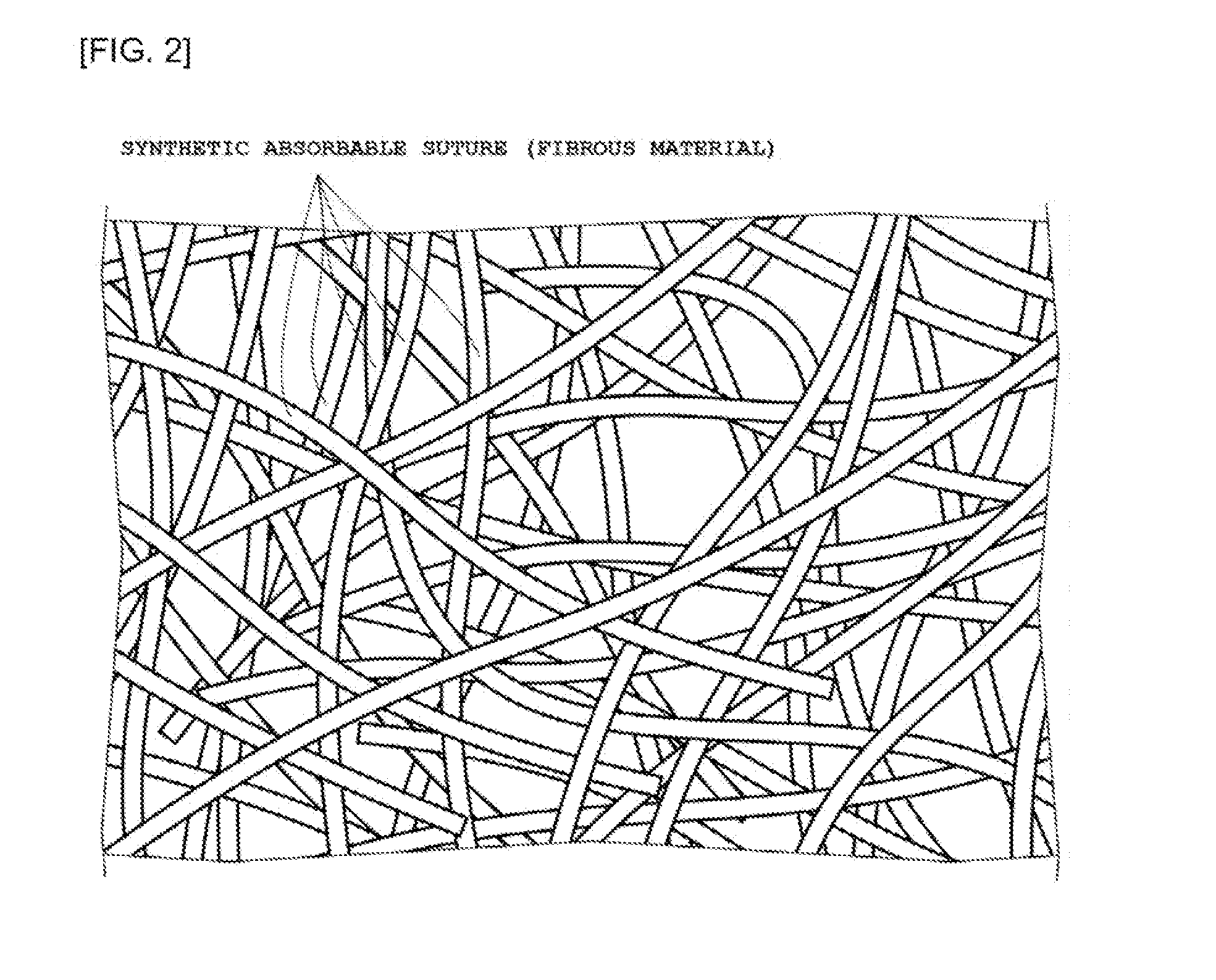 Spacer For Ionized Radiation Therapy