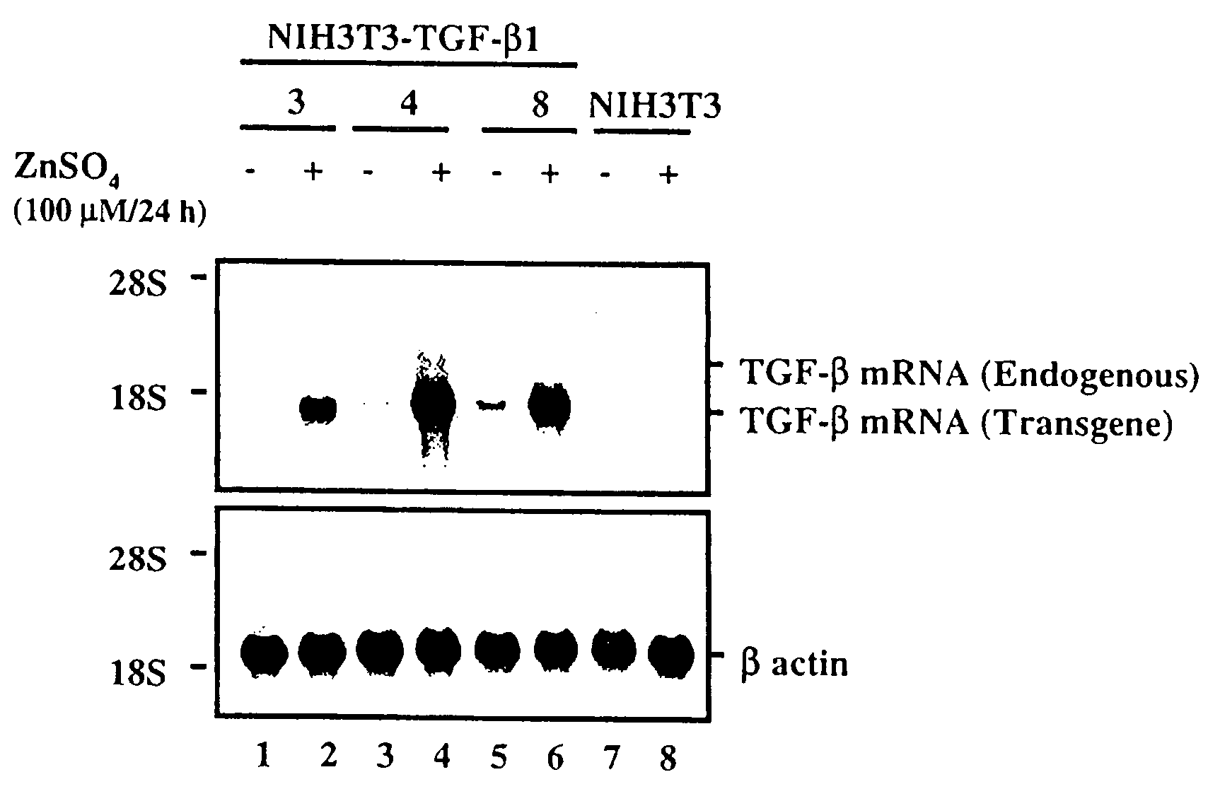 Gene Therapy Using TGF-beta