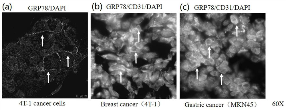 Glucoregulatory protein 78 targeting nano antibody and application thereof