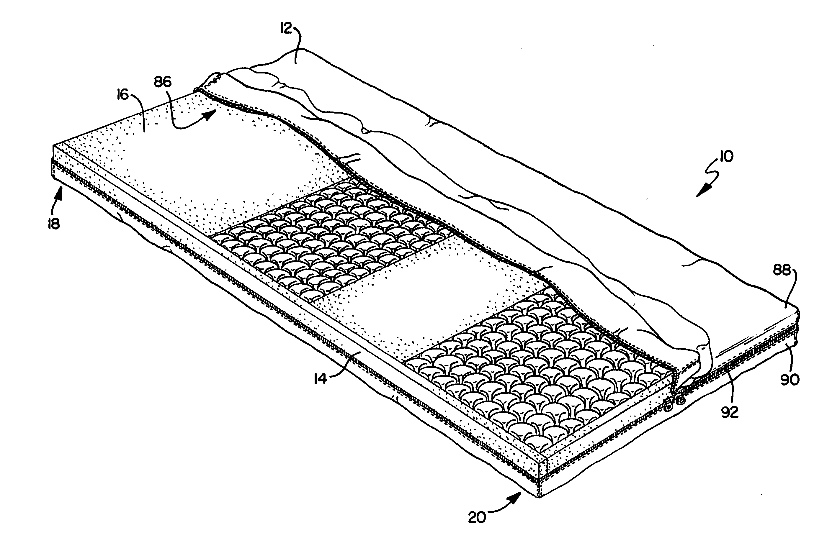 Therapeutic mattress