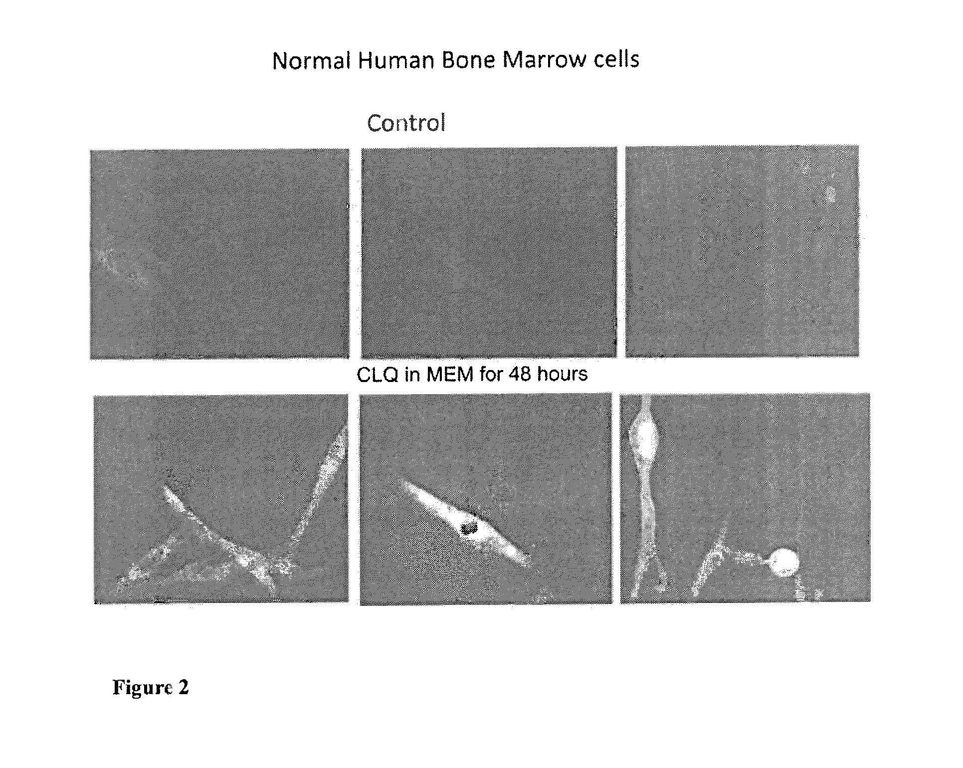 Methods of ganglioside production