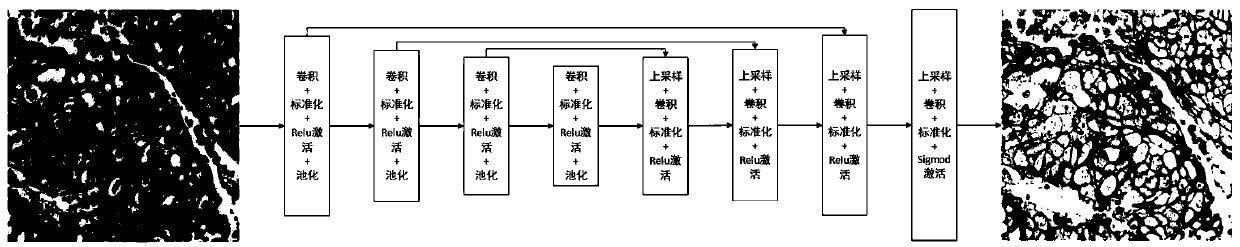 Immunohistochemical membrane staining section diagnosis method and device