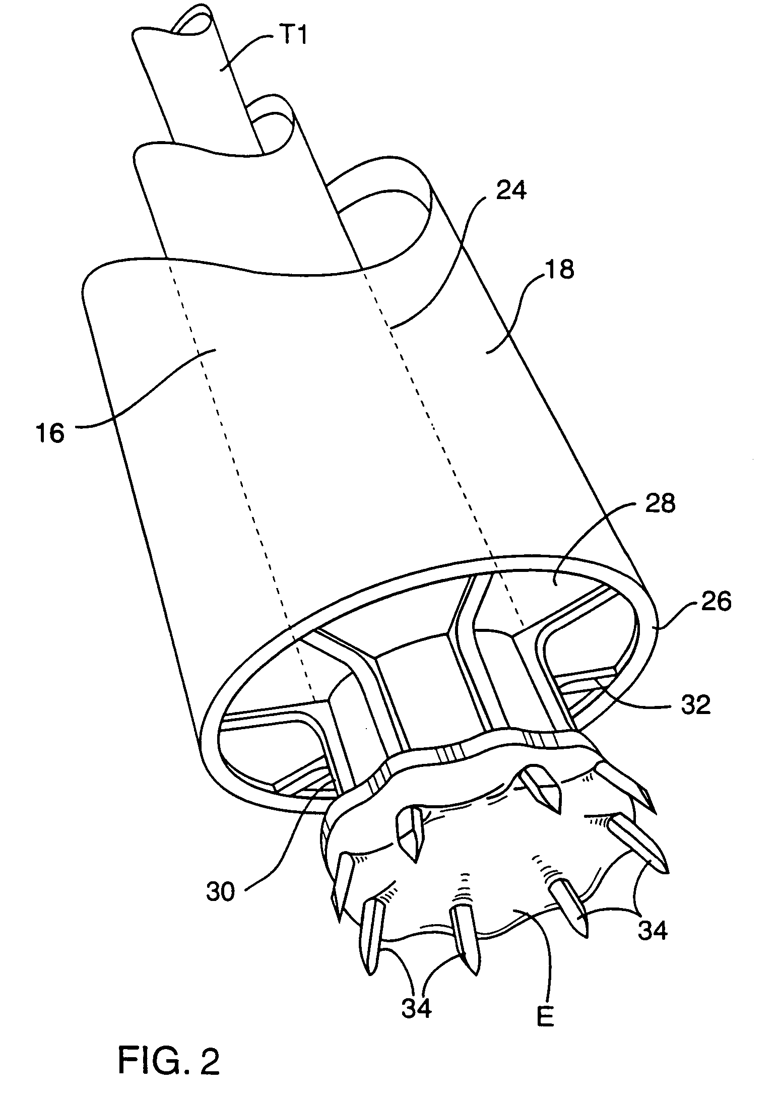 System for performing vascular anastomoses