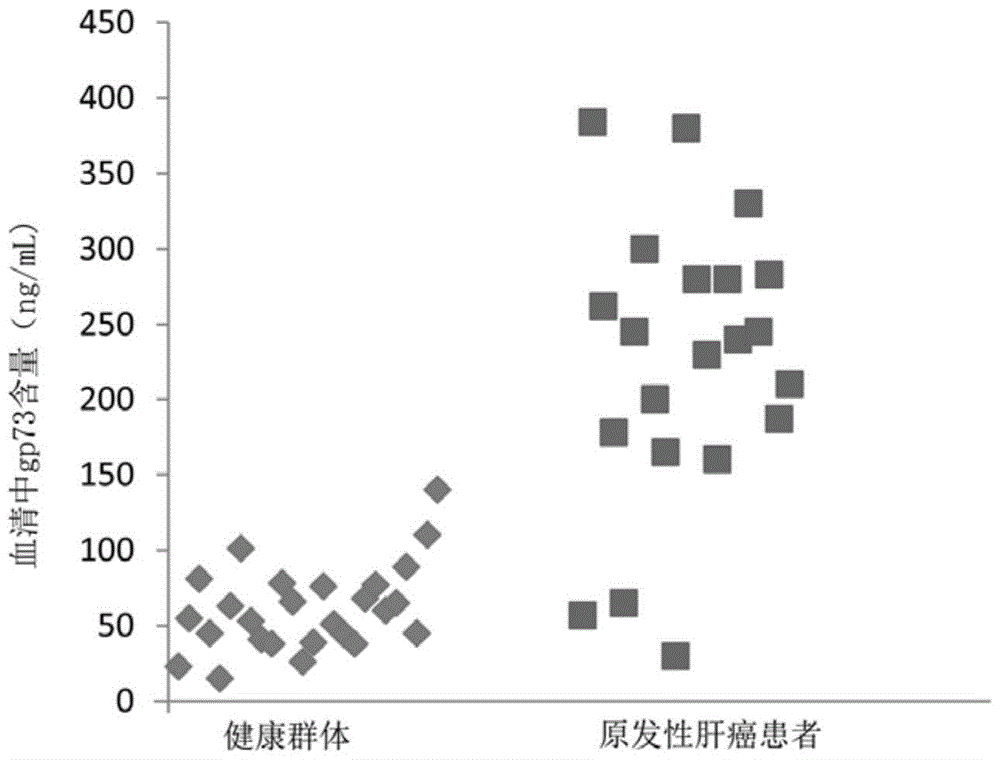 Golgi protein gp73 latex-enhanced immunoturbidimetric detection kit and preparation method thereof