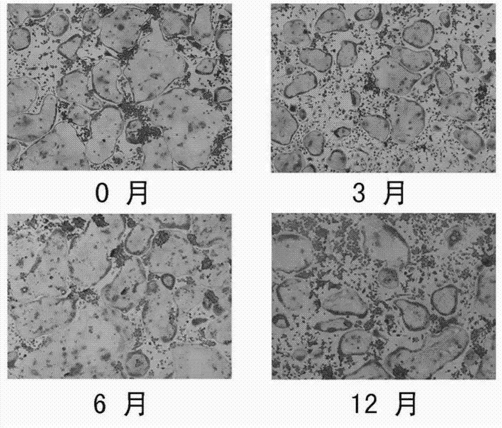 Osteoclast culturing kit and preparation method and application thereof