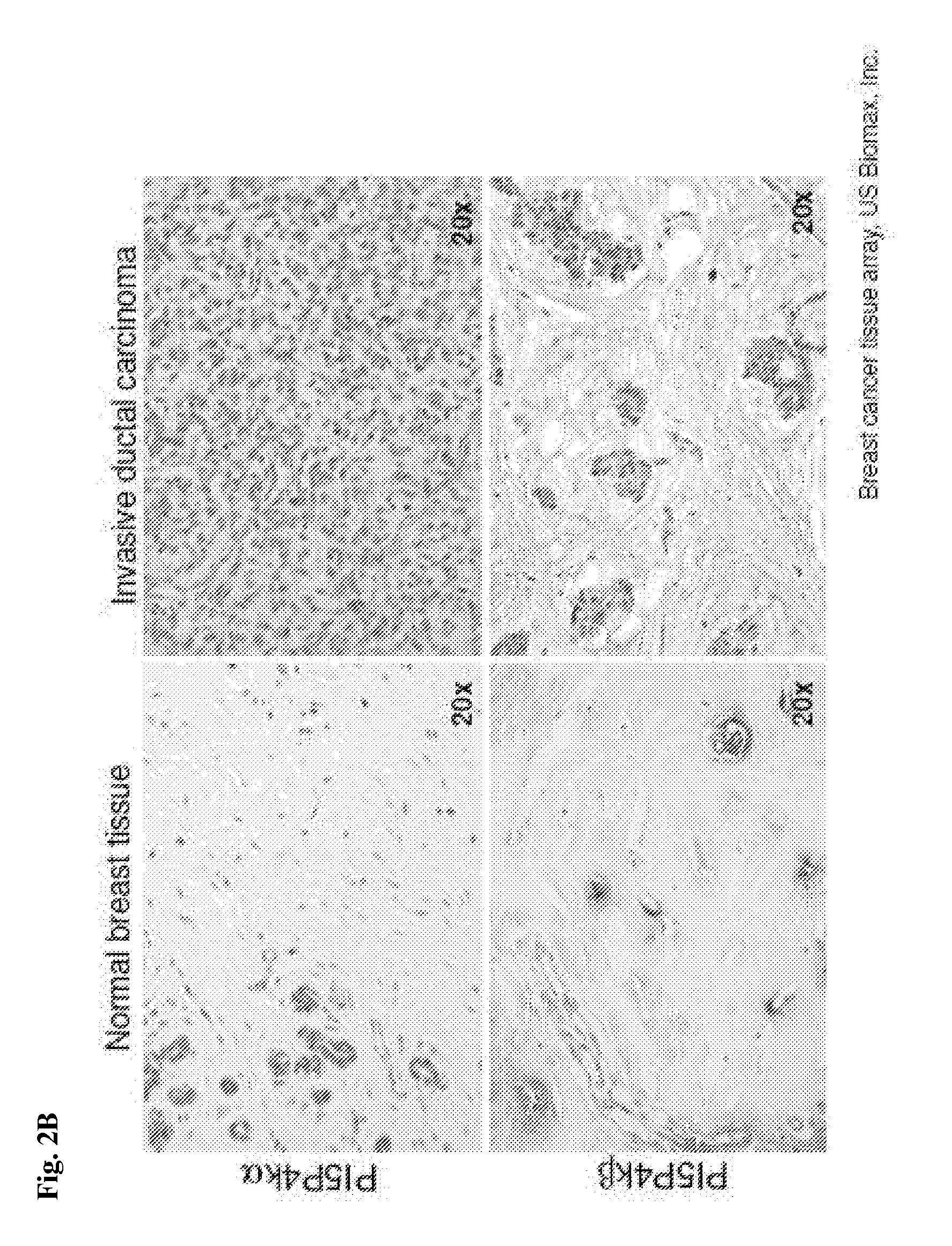 Modulation of phosphatidylinositol-5-phosphate-4-kinase activity