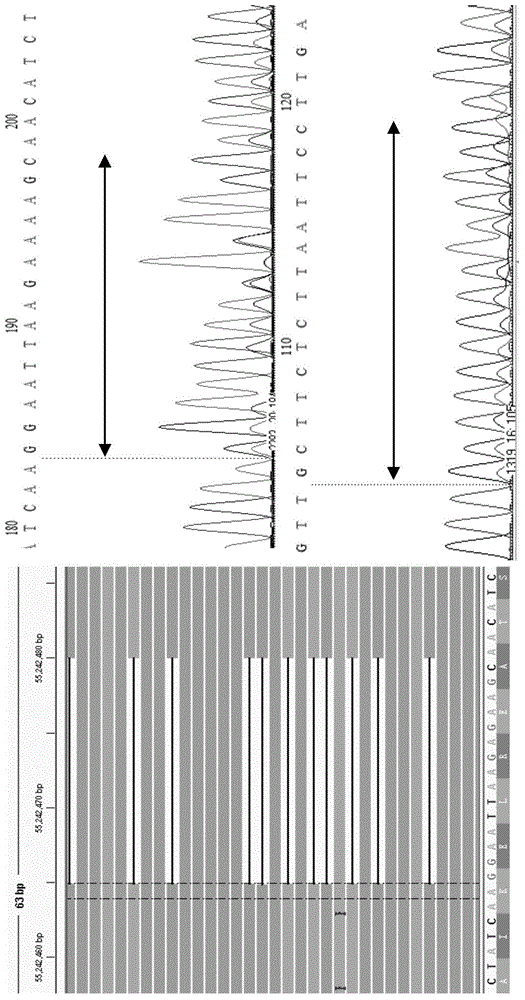 Cancer detecting method, kit and application thereof