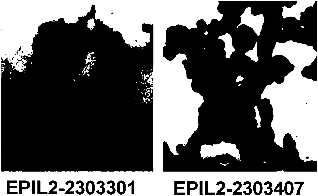 Human IL2 (interleukin 2) and anti-EpCAM (epithelial cell adhesion molecule) single-chain antibody fusion protein and application thereof