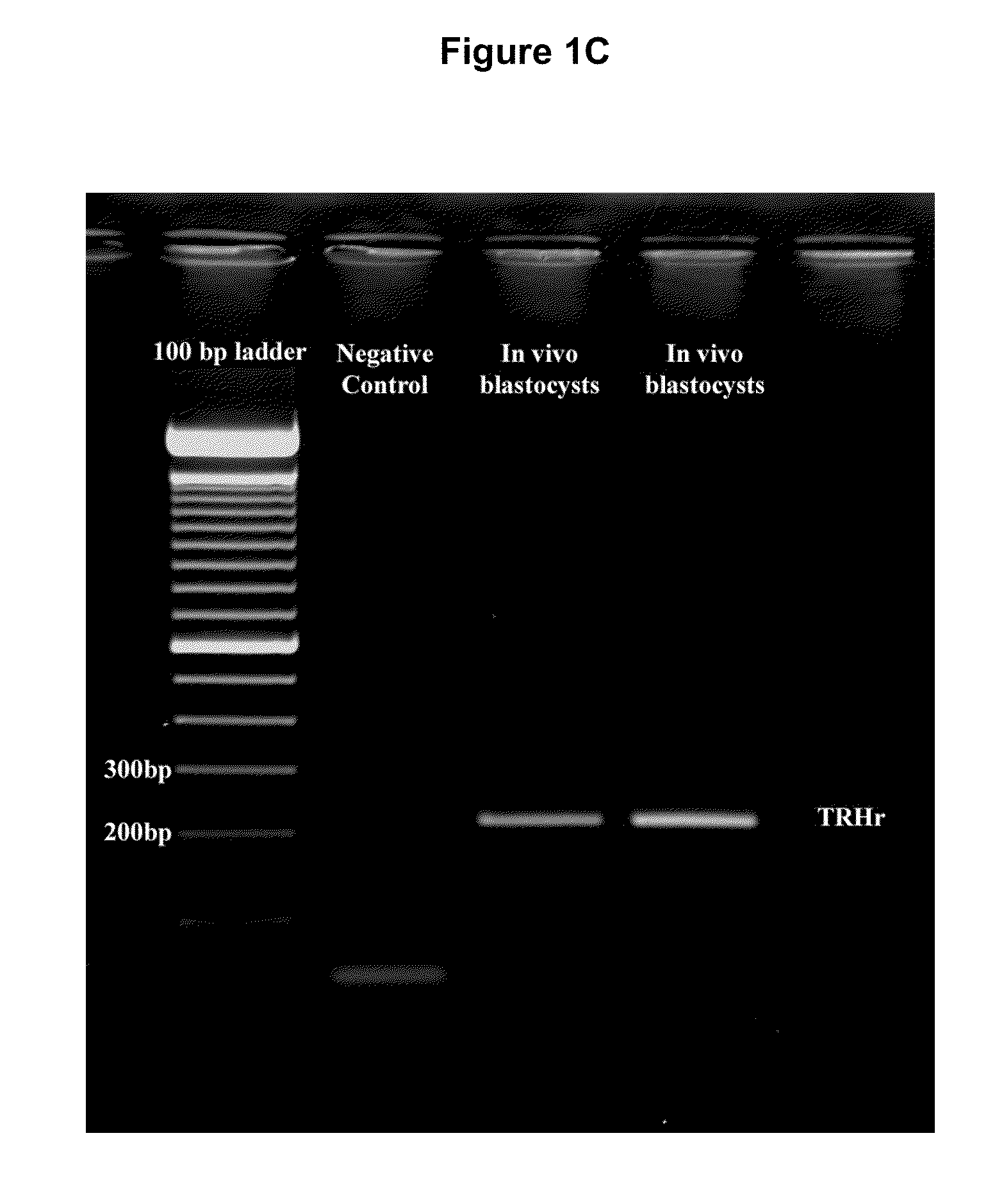 Embryo culture media containing thyroid hormone