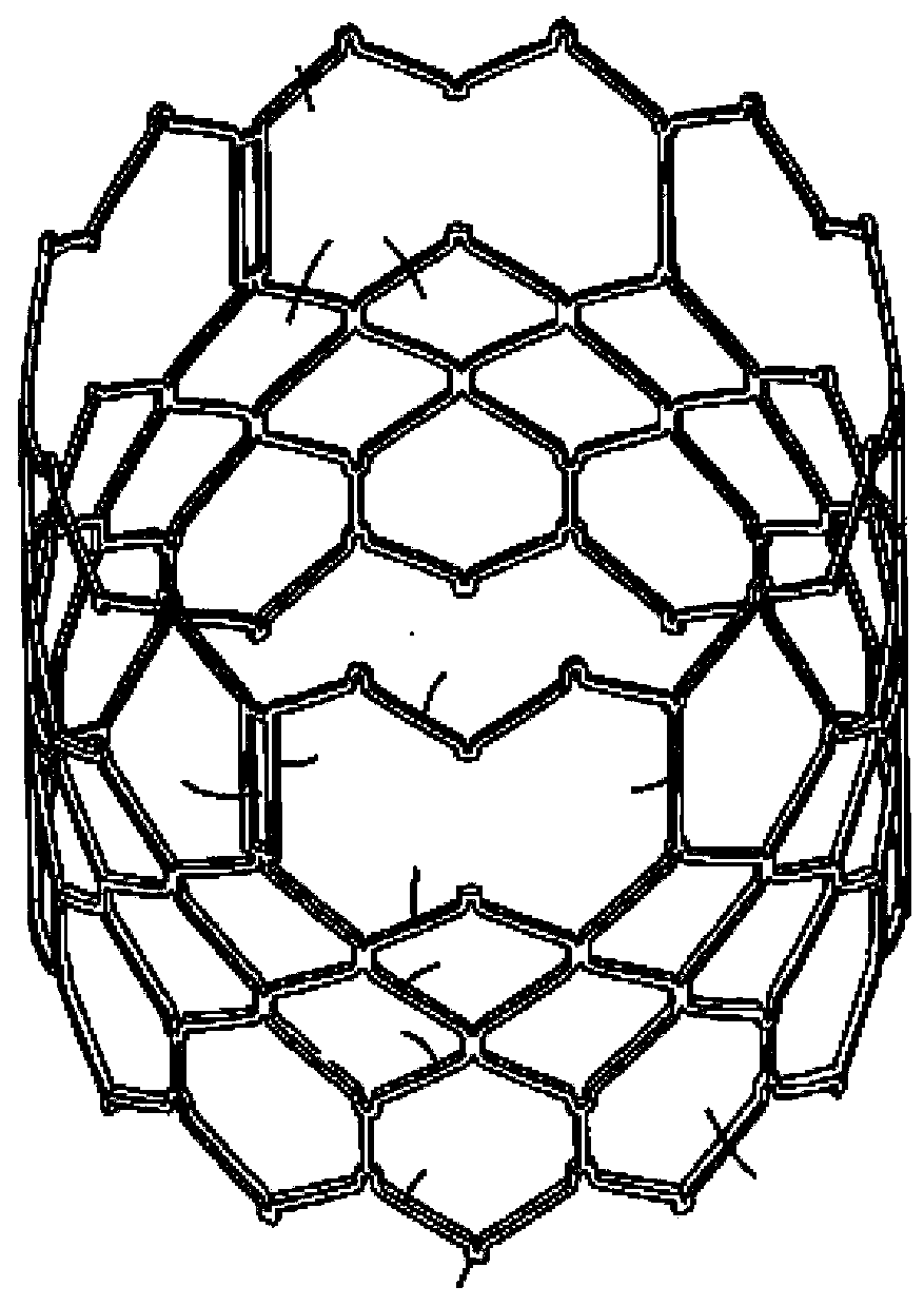 Stent used for valve-in-valve intervention