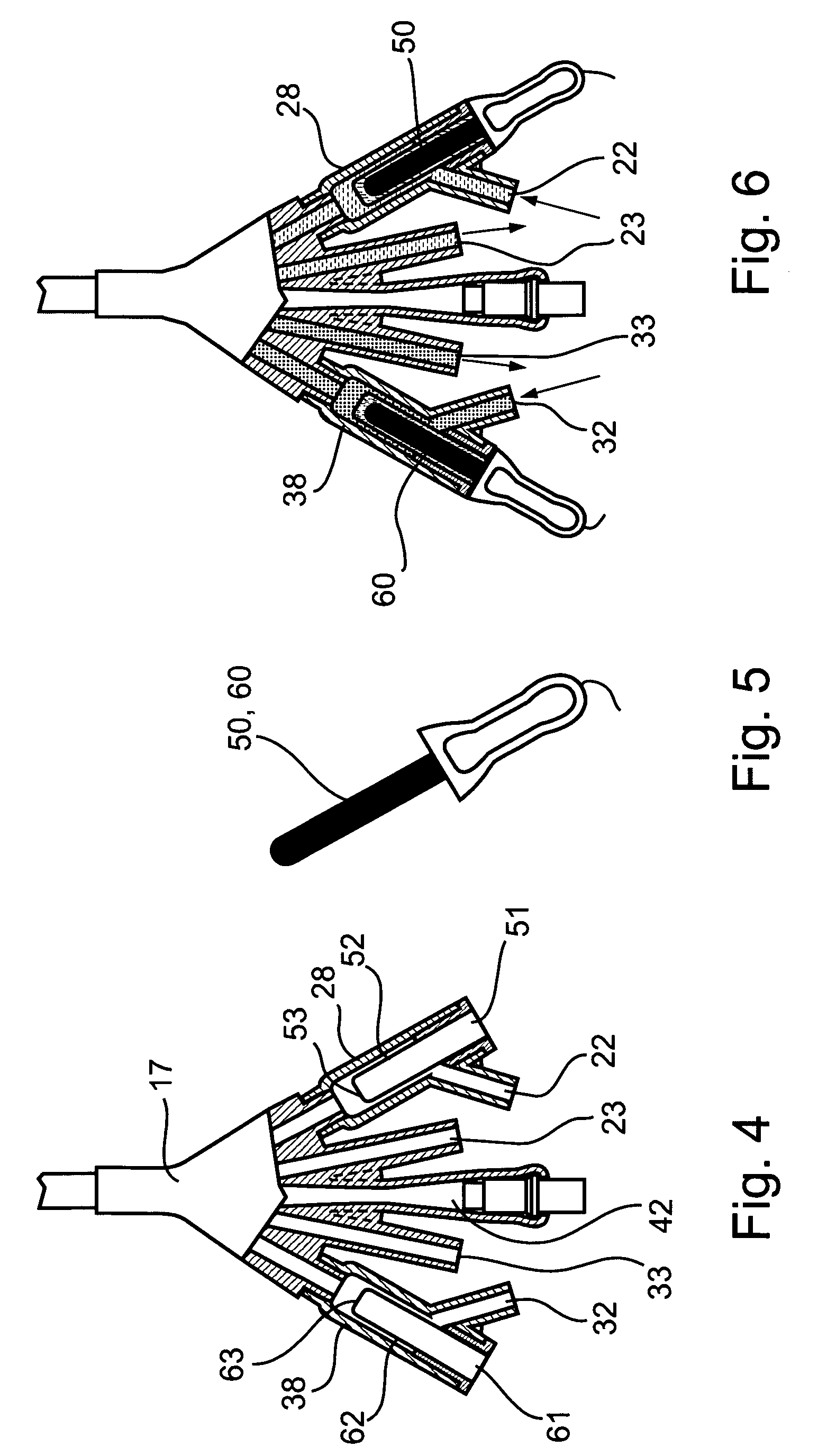 System and method for treating urinary tract disorders