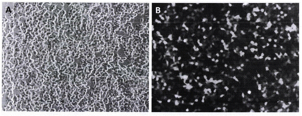 Method for preparing person stem cells with improved neural restoration function and application of person stem cells