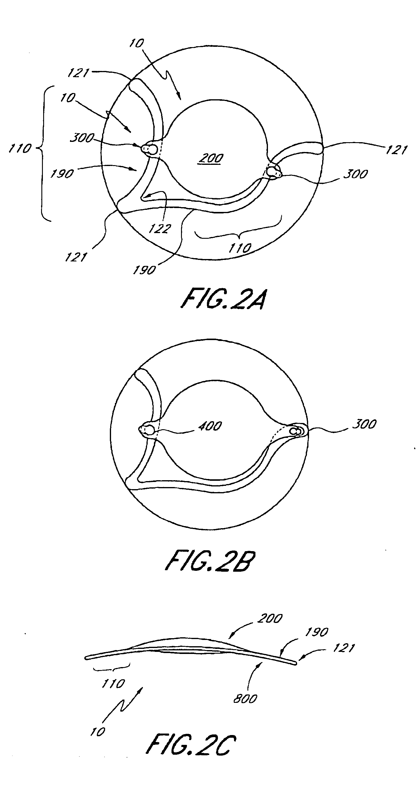 Two part "L" -shaped Phakic IOL