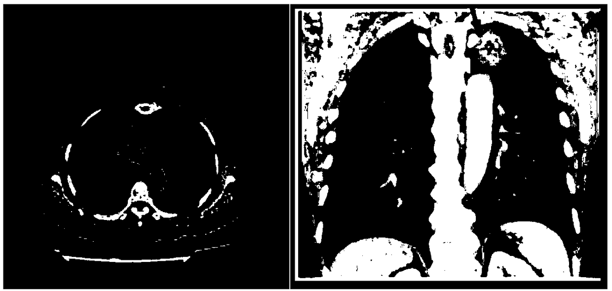 Method and device for detecting image nodules