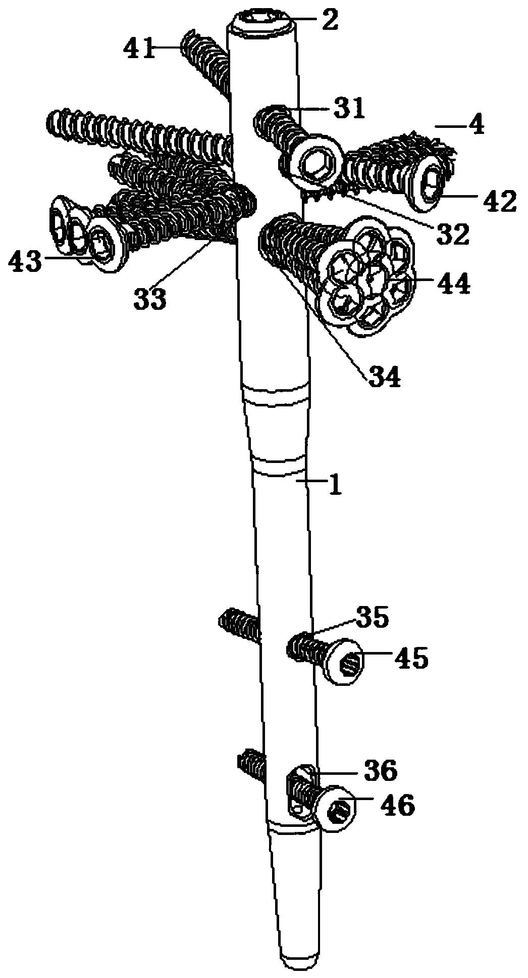 Multi-angle locking and fixing humerus straight type interlocking intramedullary pin