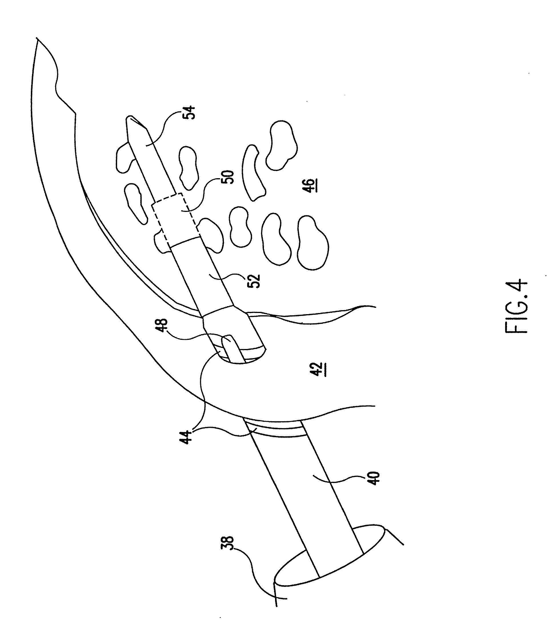 Bioabsorbable tissue tack with oval-shaped head and method of tissue fixation using the same