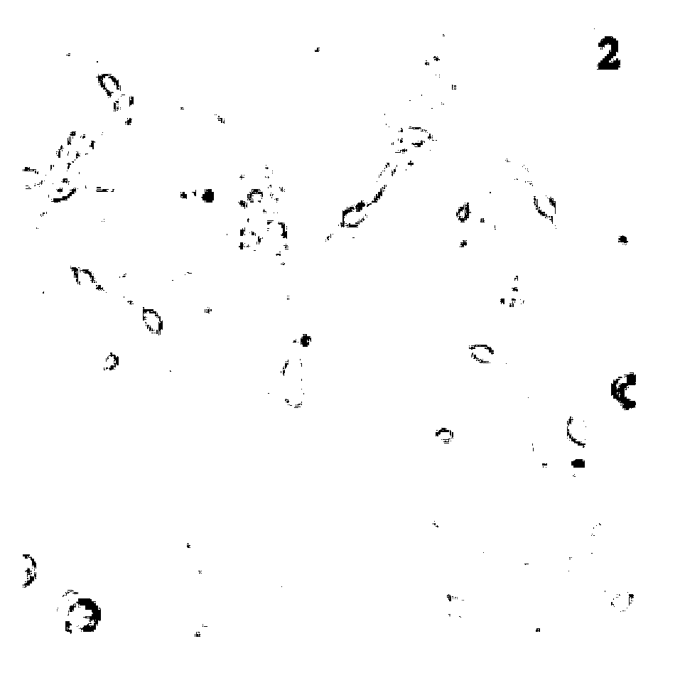 Construction method of in-vitro model for simulating mesenchymal stem cell transplantation