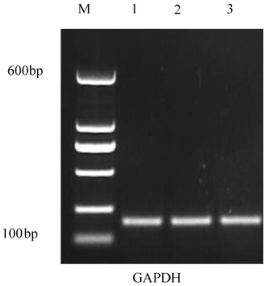 Screening method and application of meat duck real-time fluorescent quantitative PCR reference genes