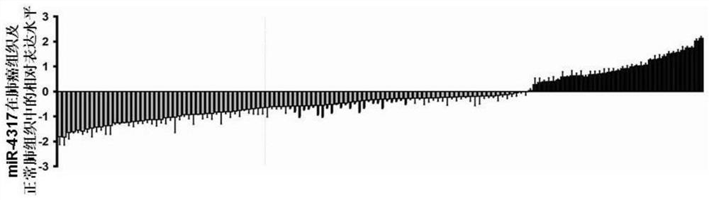 Lung cancer diagnostic marker microRNA-4317 and its application in drugs and diagnostic kits