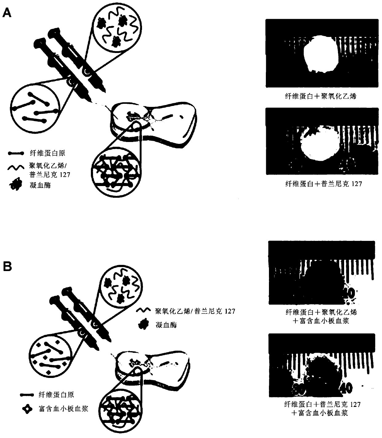 Composition for regeneration of human fibrous cartilage or elastic cartilage