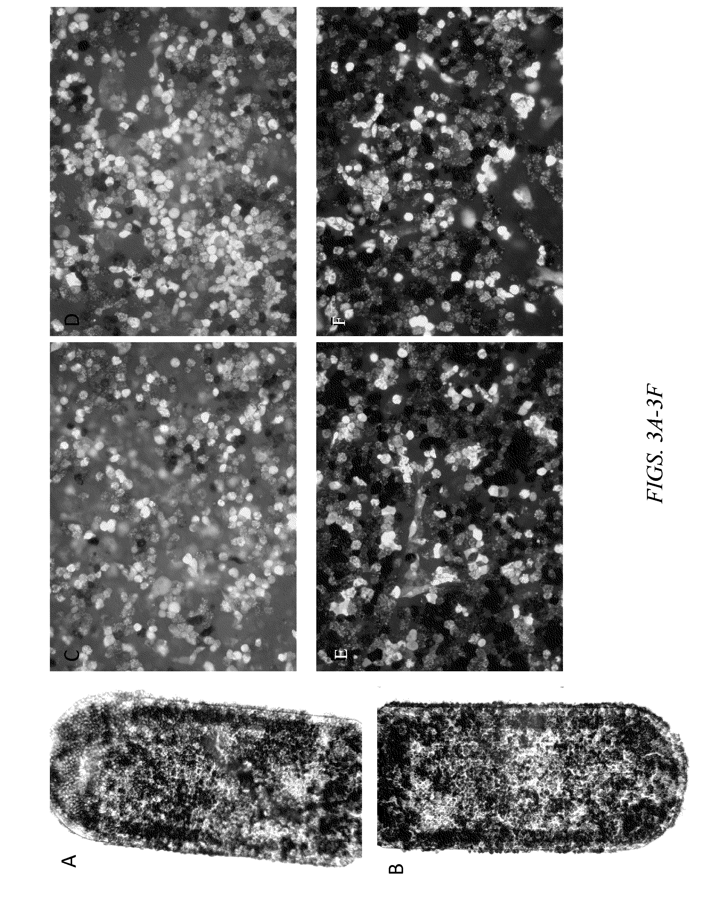 Method of cryopreservation of stem cell-derived retinal pigment epithelial cells on polymeric substrate