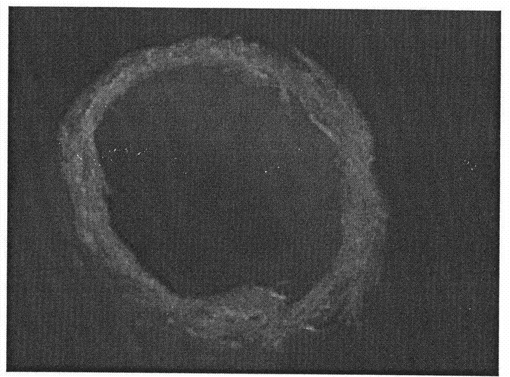 Method for preparing polyglycollide (PGA)-woven urethra scaffold for repairing urethral