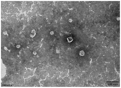 Method for separating scylla paramamosain tissue exosome