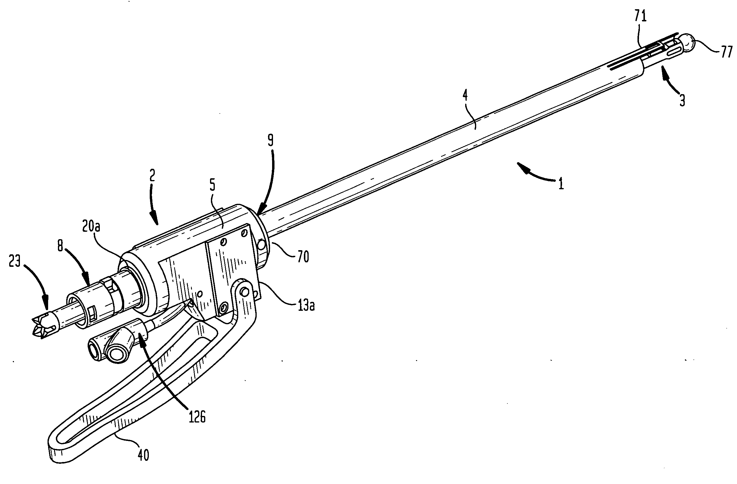 Method and apparatus for removal of tissue