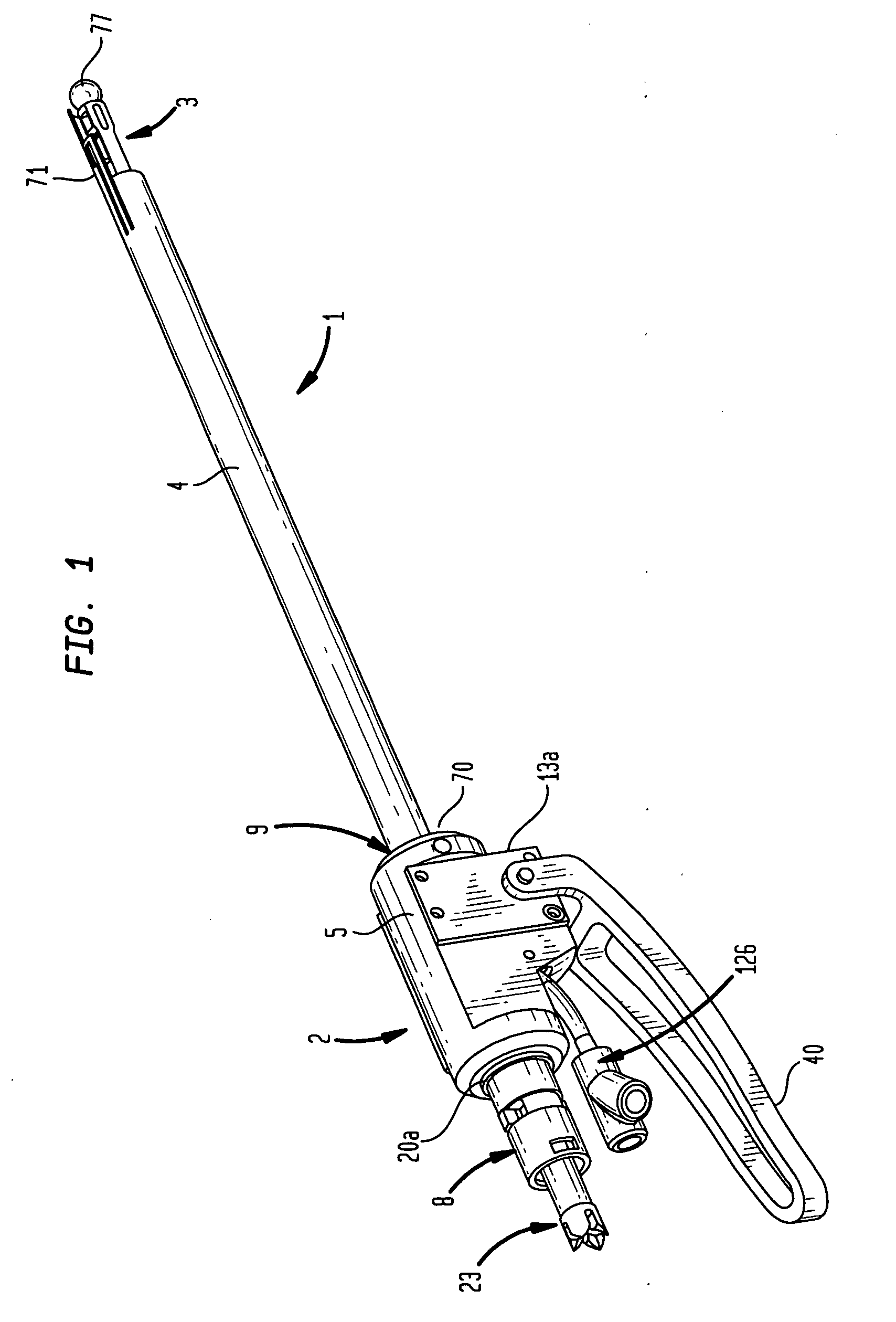 Method and apparatus for removal of tissue