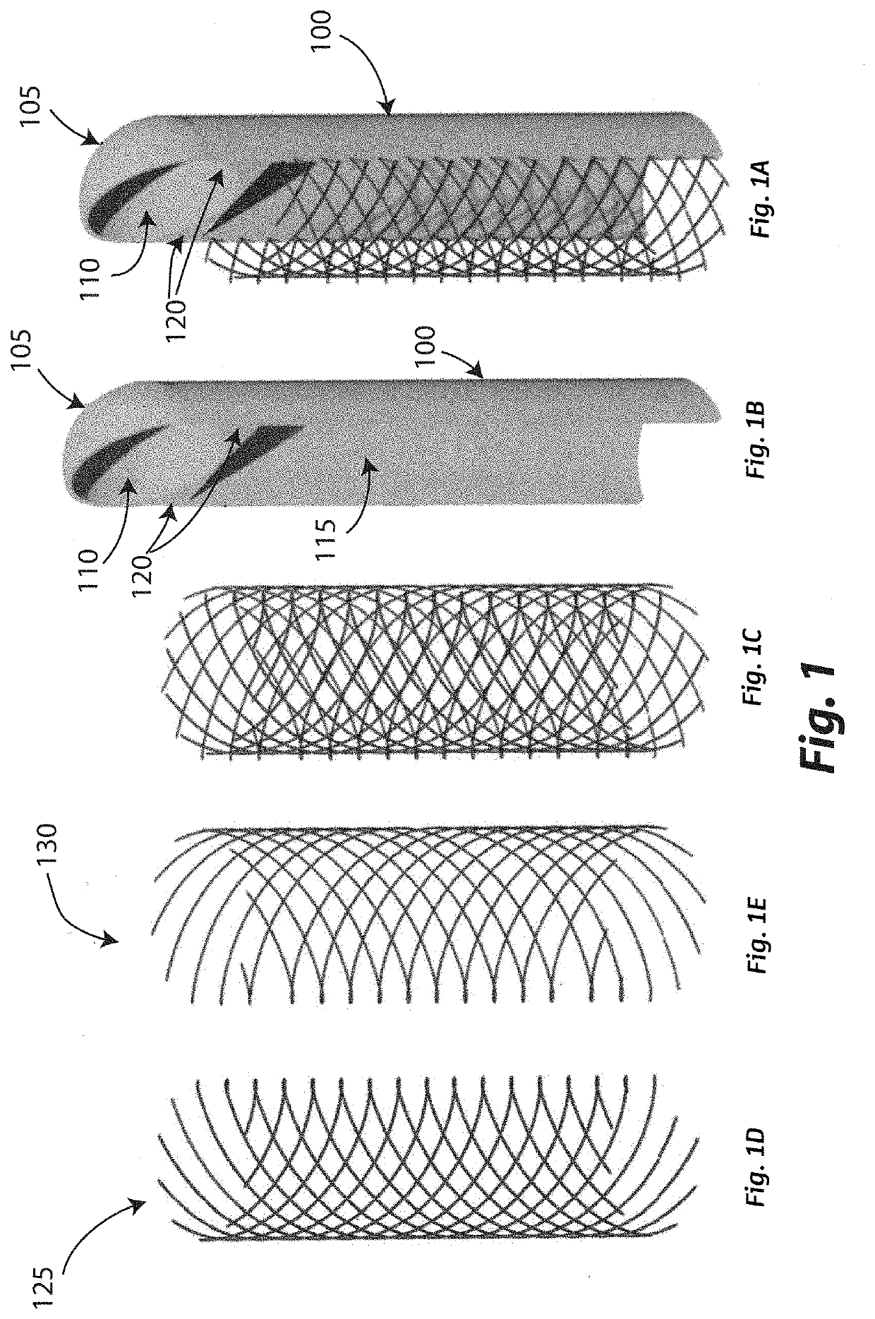 Three-dimensional Helicoidal Post-Tensioning and Reinforcement Strategy for Concrete Anchor Applications