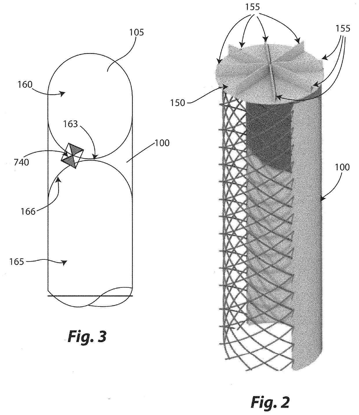 Three-dimensional Helicoidal Post-Tensioning and Reinforcement Strategy for Concrete Anchor Applications