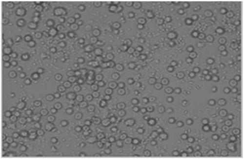 Culture medium capable of amplifying number of endothelial progenitor cells