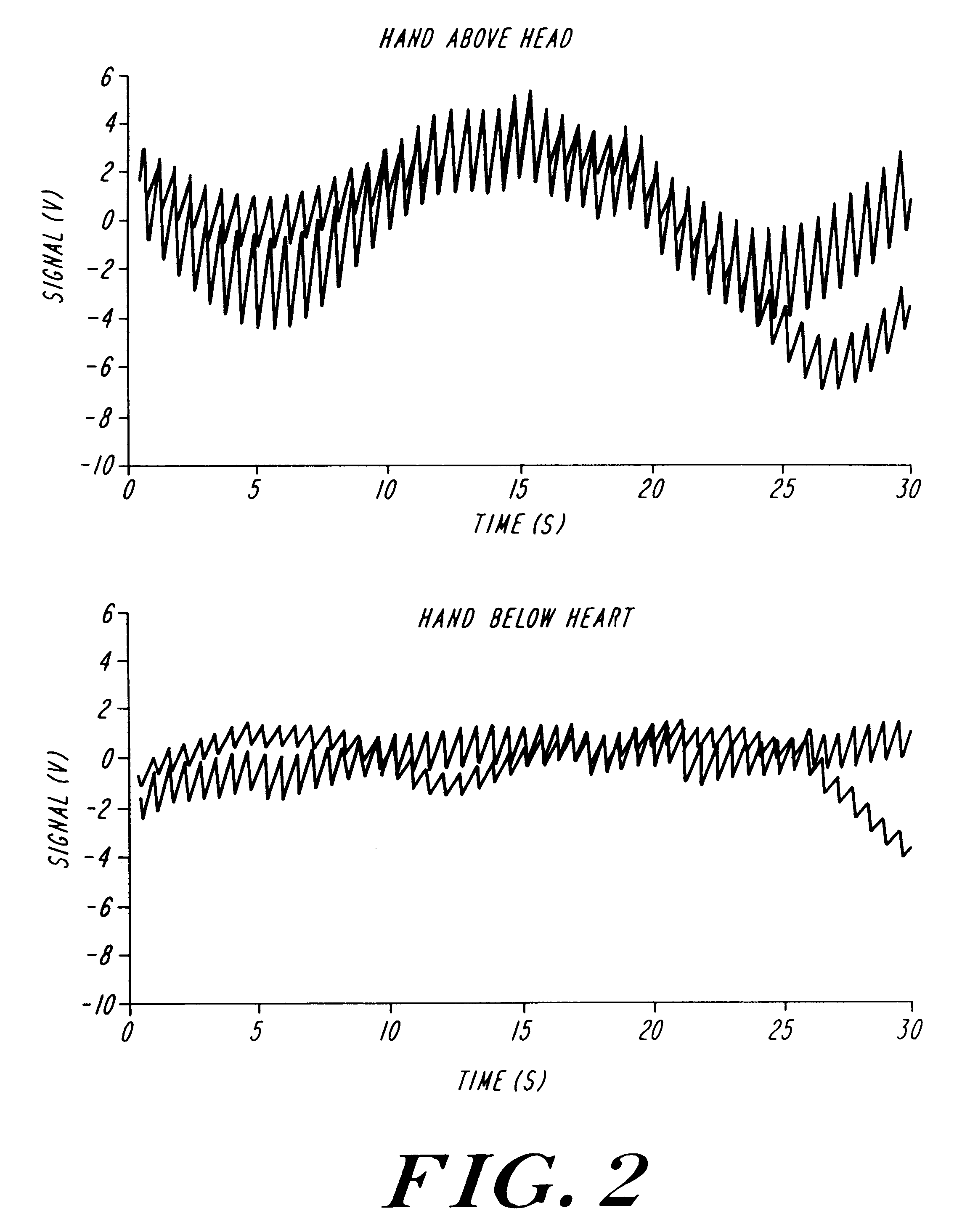 Method of improving reproducibility of non-invasive measurements